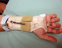 Hand Therapy - Hand Goniom
