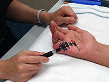 Hand Assessment - Sensory Test