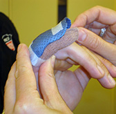 Applying Finger Splint