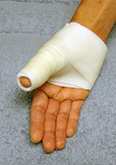 Thumb Soft Cast